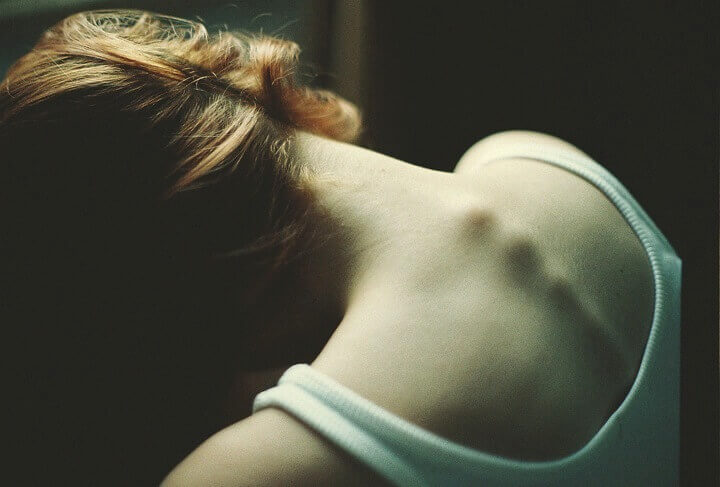 Anorexia: quando a magreza excessiva é a ponta de um iceberg