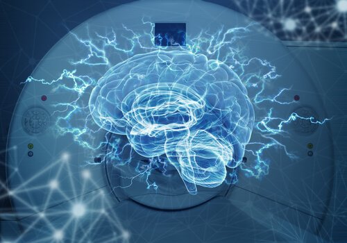Diferenças entre a tomografia axial computadorizada e a ressonância magnética