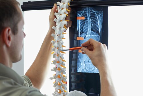 4 exercícios para prevenir a escoliose