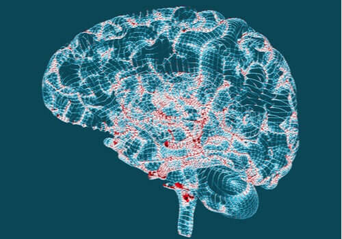 Doença de Huntington