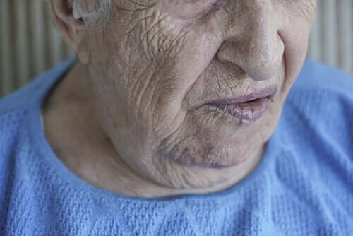 Paralisia facial: quando o rosto não responde