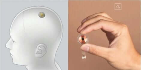 Neuralink: o chip que vai conectar o cérebro a um computador