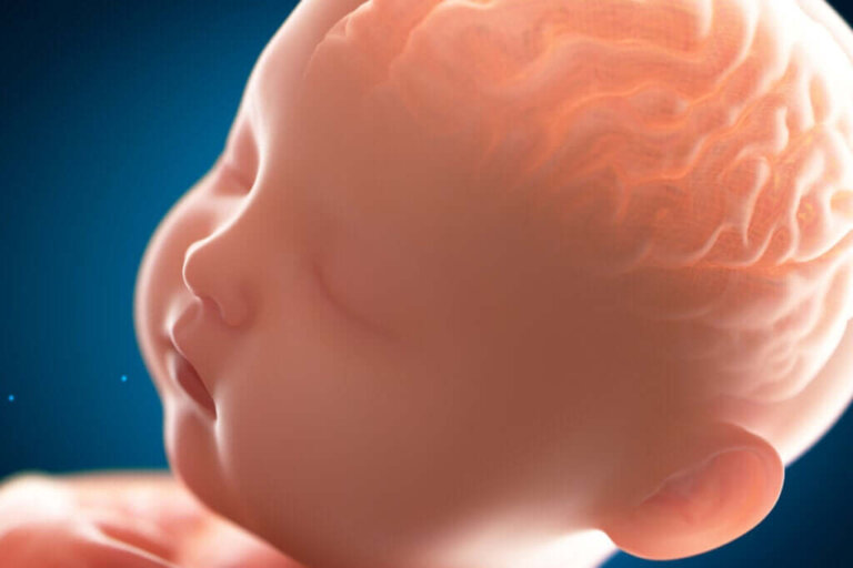 Paquigiria: o cérebro "liso"