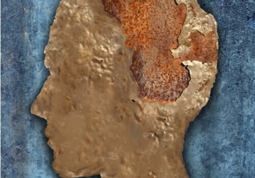 Encefalopatia espongiforme, a doença da vaca louca