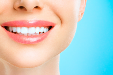 Brancorexia: a perigosa obsessão pelos dentes brancos